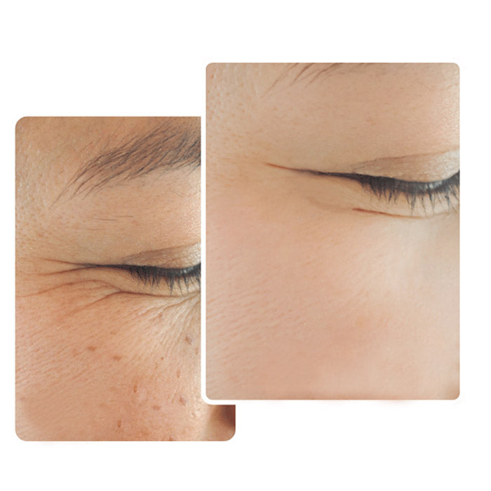 Suero aclarante anti-melasma + bloqueador solar Gimiya Whitening